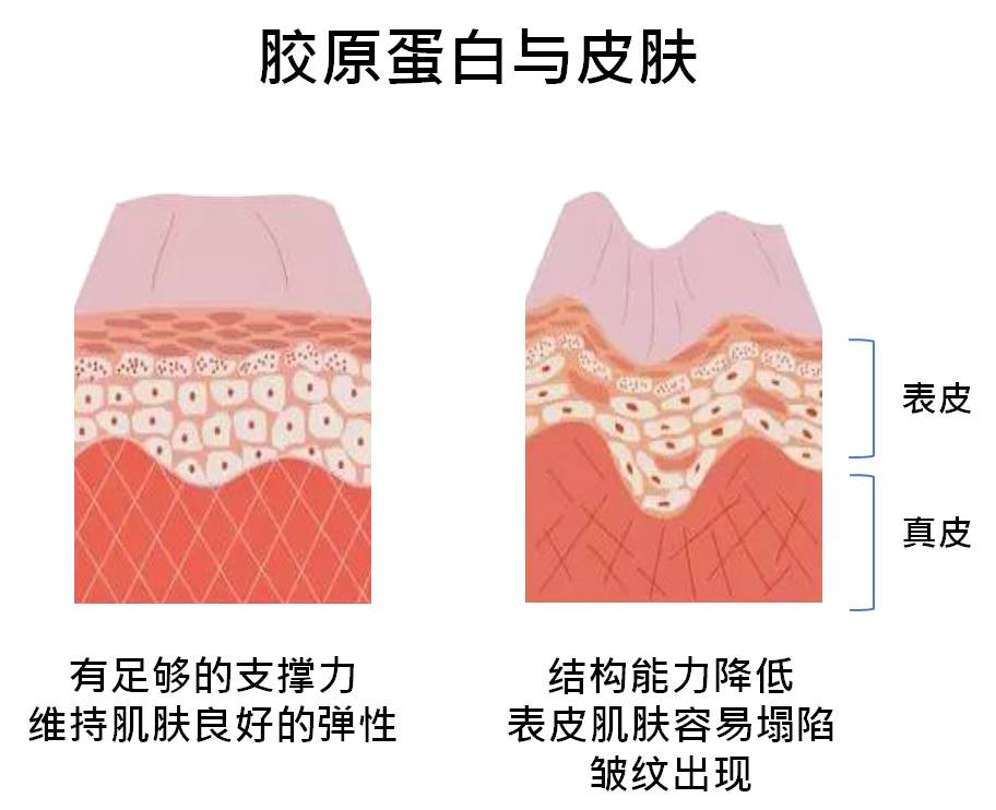choyu